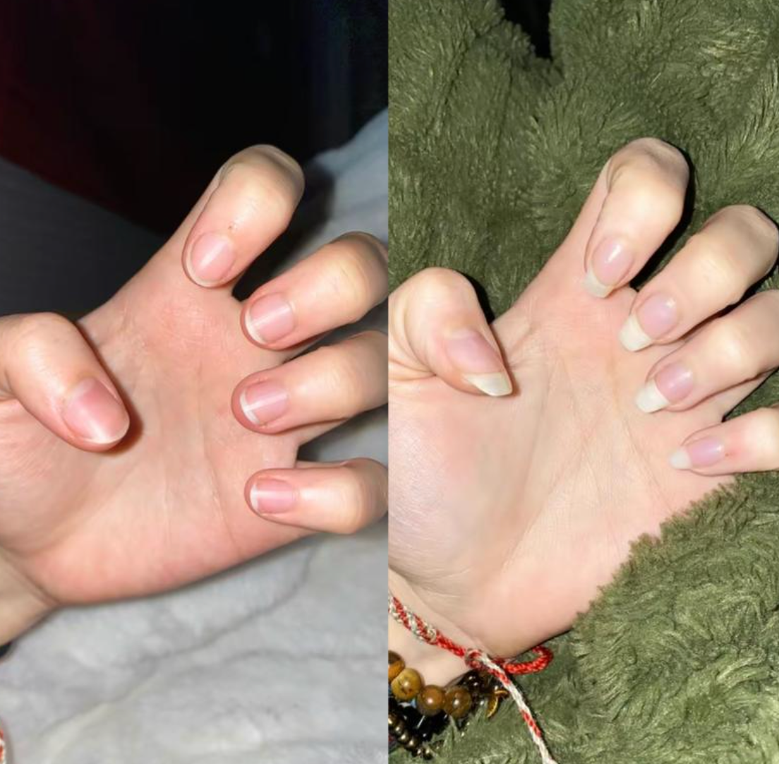 Nail Growth Oil