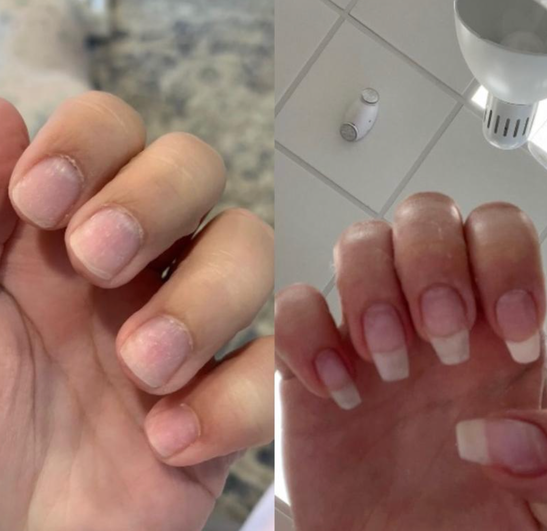 Nail Growth Oil