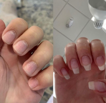 Nail Growth Oil
