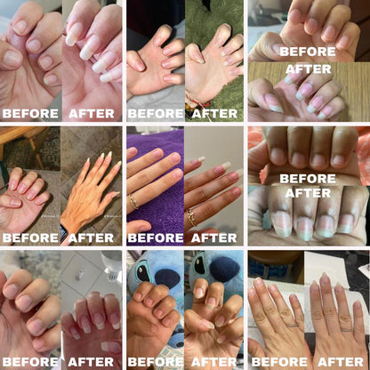 Nail Growth Oil